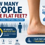 how many people have flat feet